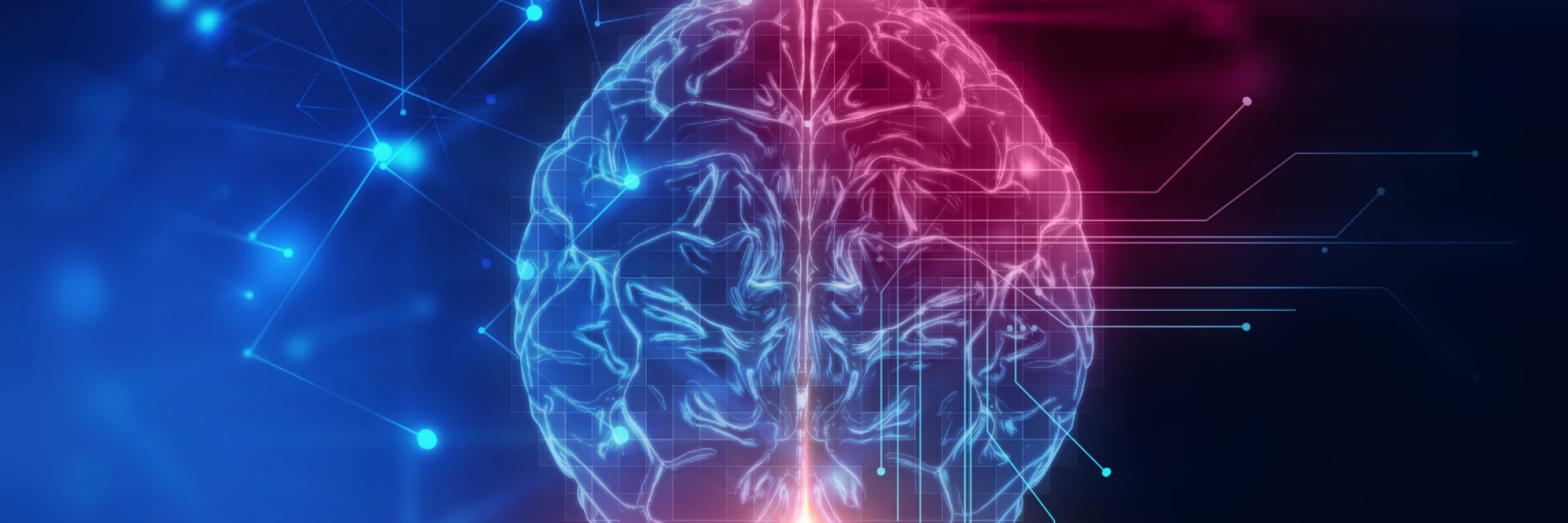 AI in Radiology